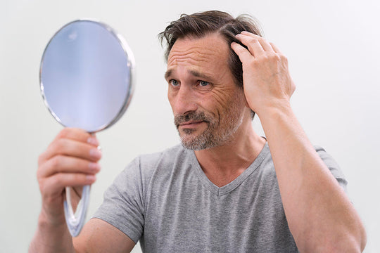 Men Hair Loss